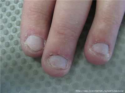Наращивание ногтей на очень короткие ногти » Онлайн-журнал для женщин и девушек