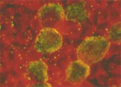 Хламидиоз у мужчин и женщин - лечение, симптомы и признаки, заражение