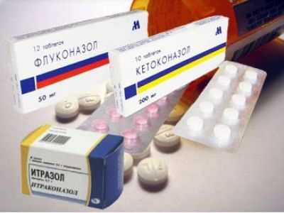 Как лечить молочницу в домашних условиях