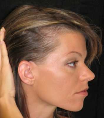 Почему у женщин выпадают волосы?