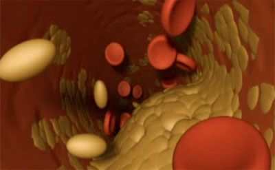 Холестерин общий