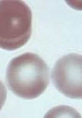 Холестерин общий