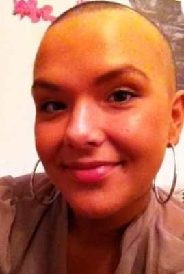 Выпадение волос у мужчин можно остановить