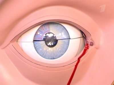 Боли при беременности, головная боль, боль в спине и животе