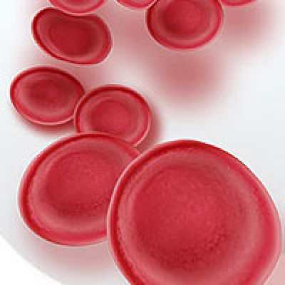 Причины низкого гемоглобина в крови