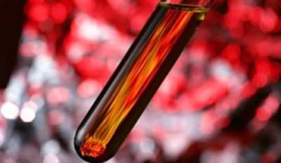 Причины низкого гемоглобина в крови