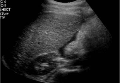 Что может болеть внизу живота?