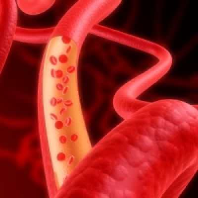 Повышенный гемоглобин - что делать?