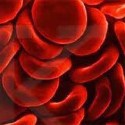 Повышенный гемоглобин - что делать?