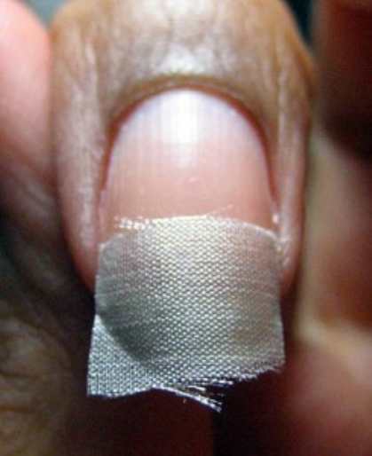 Чиним надломившийся ноготь