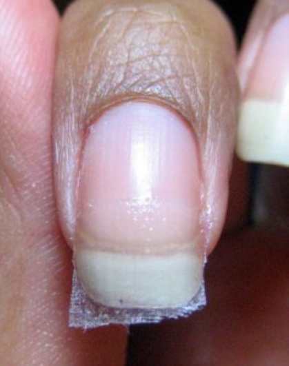 Чиним надломившийся ноготь