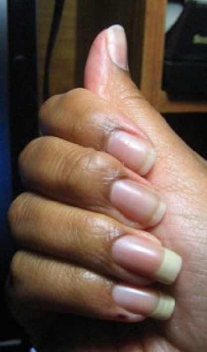 Чиним надломившийся ноготь