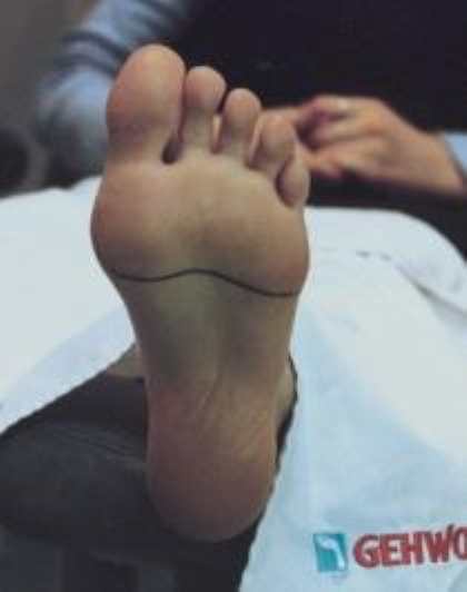 Массаж стоп при беременности