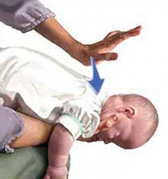 Если подавился малыш