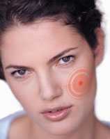 Лечение фурункула в домашних условиях