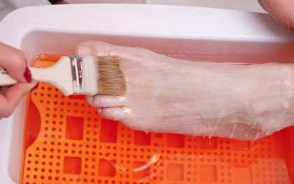 Парафинотерапия