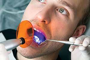 Отбеливание зубов. Вопрос-ответ