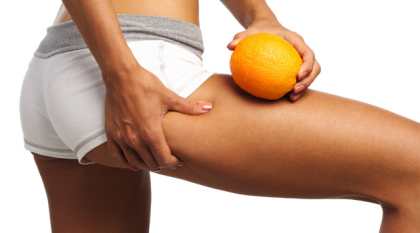 7 мифов о целлюлите, в которые пора перестать верить