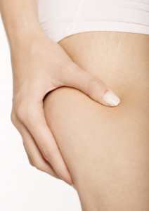 Избавиться от растяжек? Это возможно?